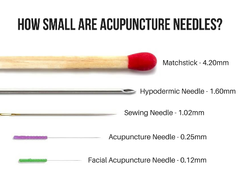 Acupuncture needles are as thin as a human hair 10 times thinner than a sewing needle.